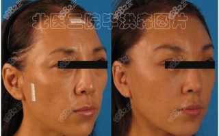 有面容和无面容什么意思