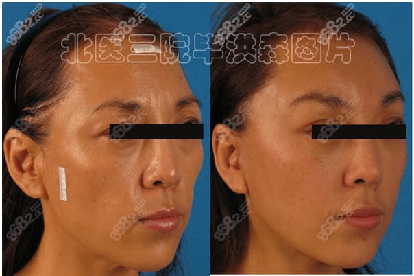 有面容和无面容什么意思-第1张图片-王尘宇